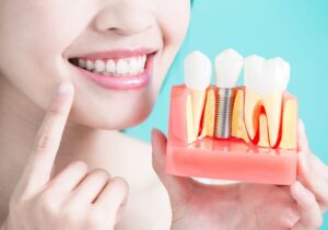 como funciona um implante dentário e quais são os benefícios oral unic capa