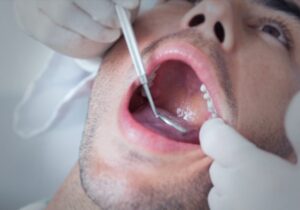 Estou Com Feridas No Céu Da Boca, Causas e Tratamento