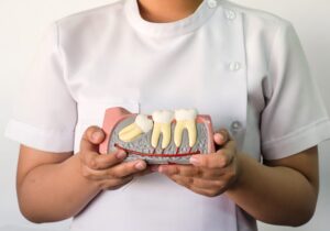 Quando Devo Extrair o Dente de Siso Descubra Aqui